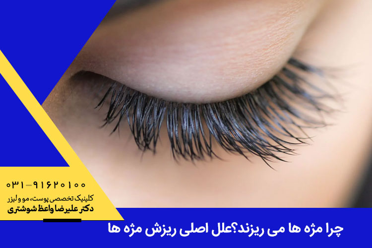 علل اصلی ریزش مژه ها