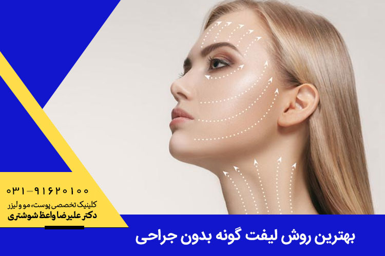 بهترین روش لیفت گونه بدون جراحی