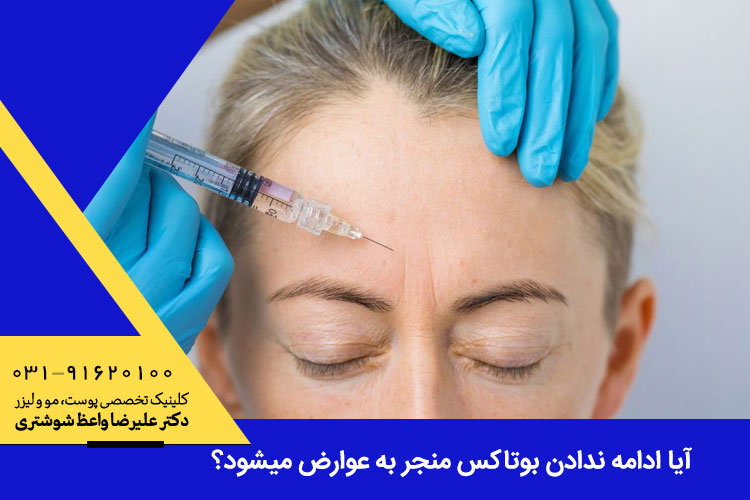 عوارض عدم تکرار بوتاکس