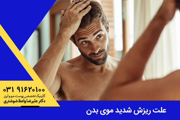 علت ریزش شدید موی بدن