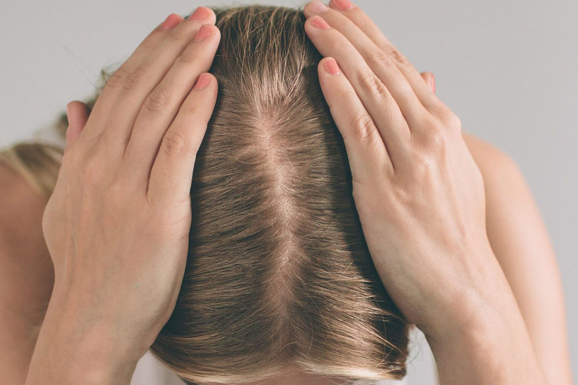 ریزش موی زنان