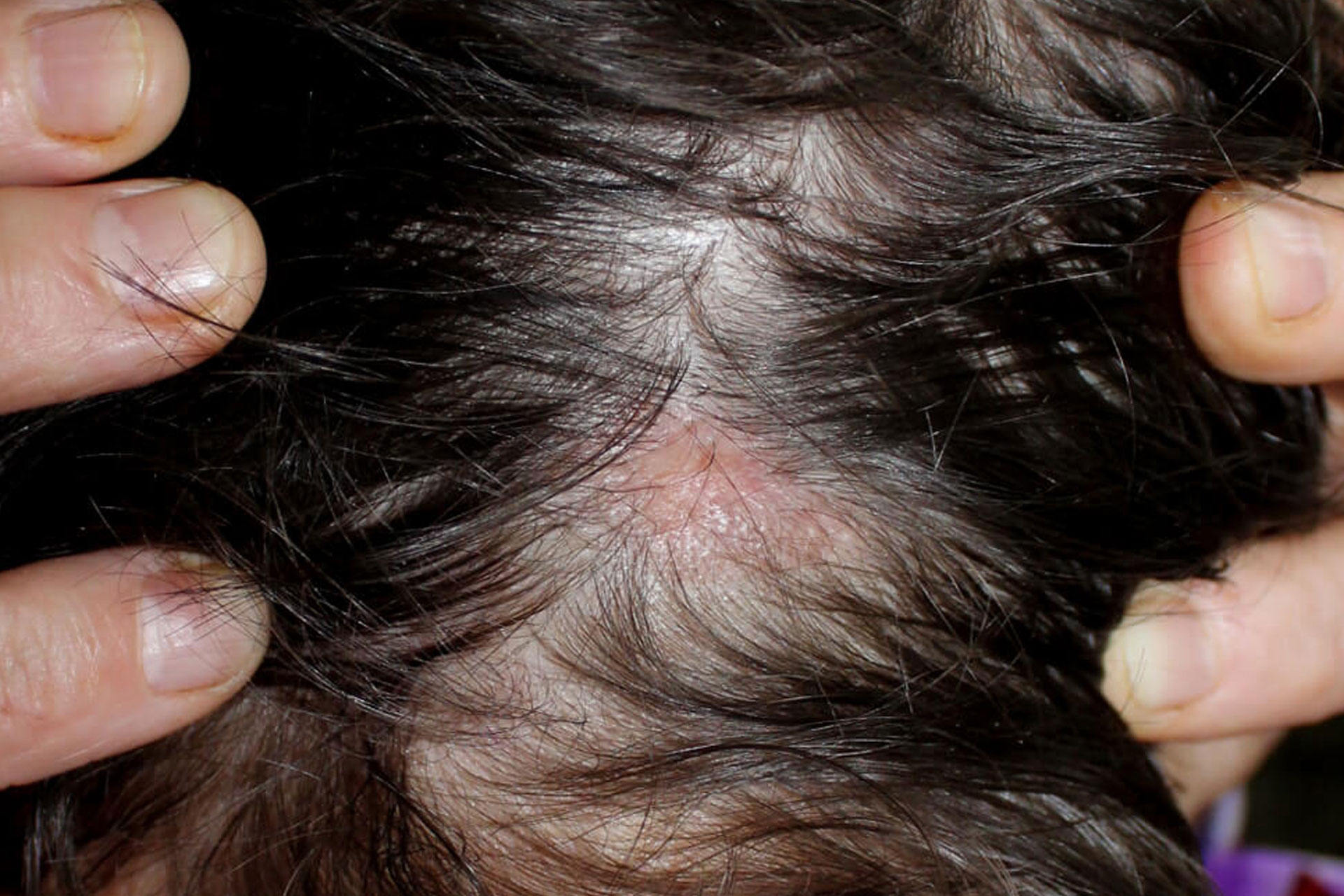 لیکن پلان سر