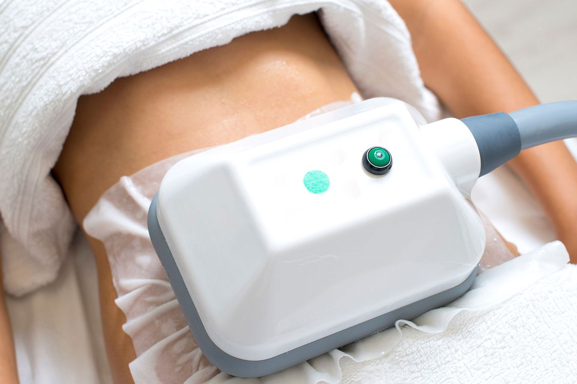 کرایولیپولیز