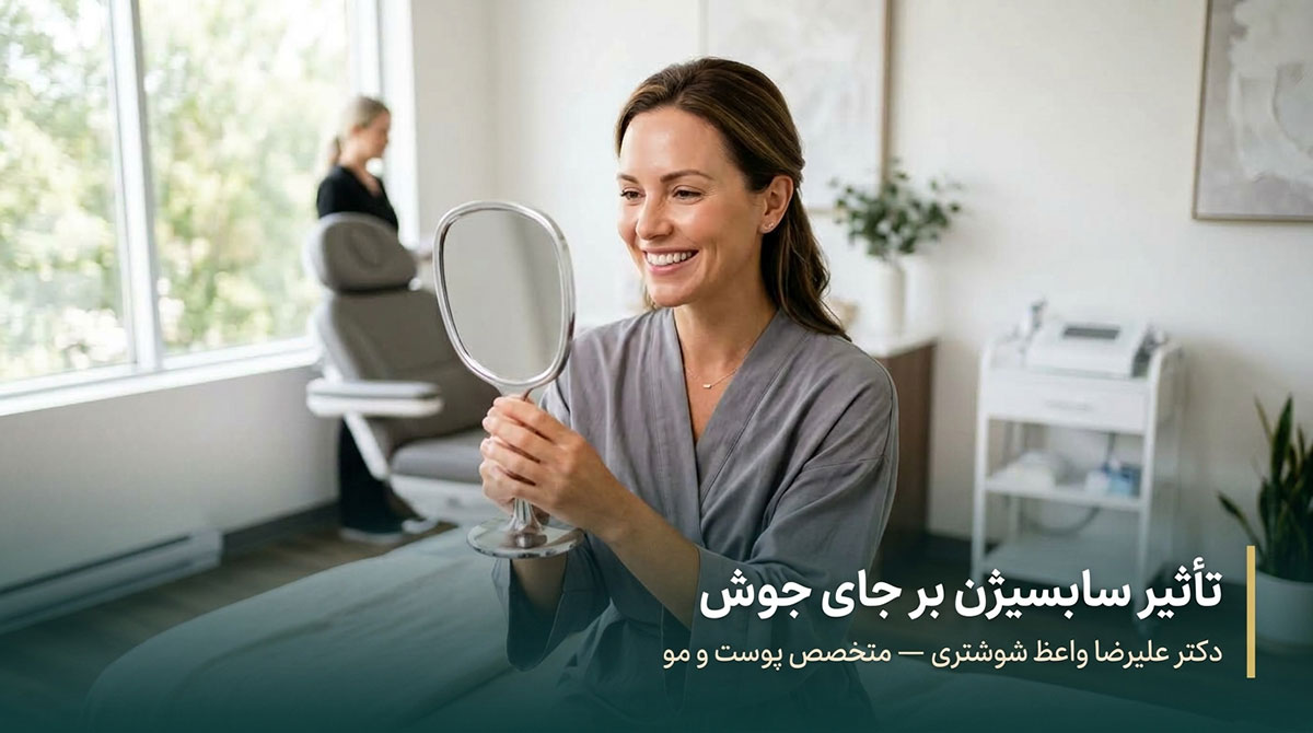 تاثیر سابسیژن بر جای جوش