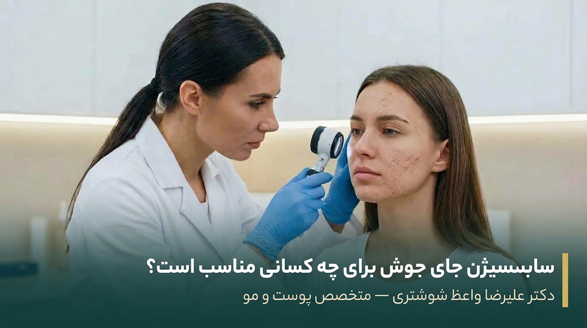 سابسیژن جای جوش برای چه کسانی مناسب است