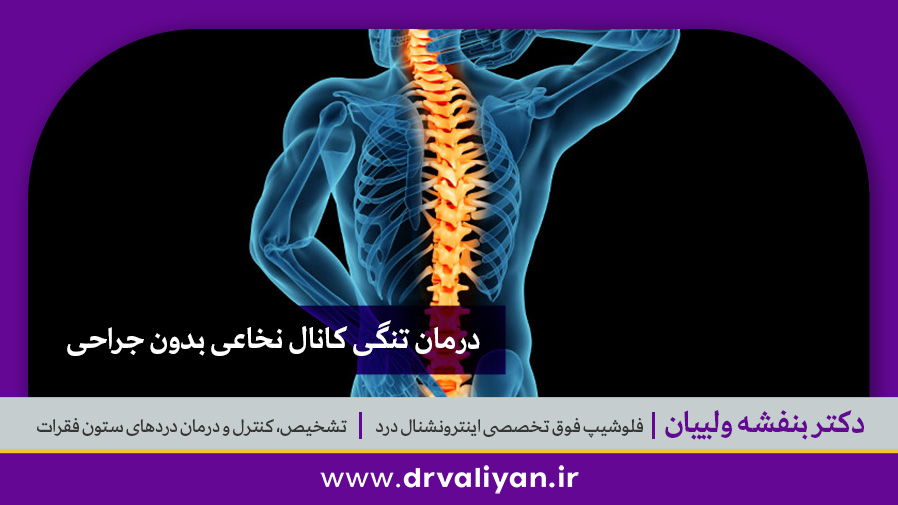 تنگی کانال نخاع
