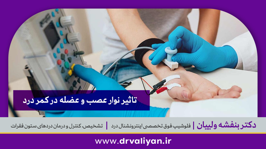 تاثیر نوار عصب و عضله در کمر درد