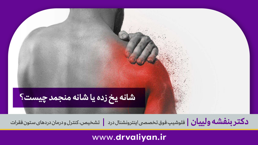 شانه یخ زده