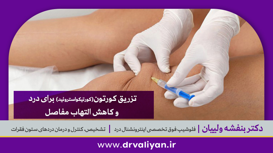 تزریق کورتیزون