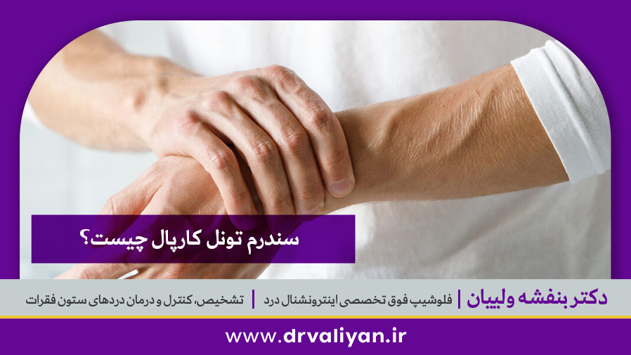 سندرم تونل کارپال