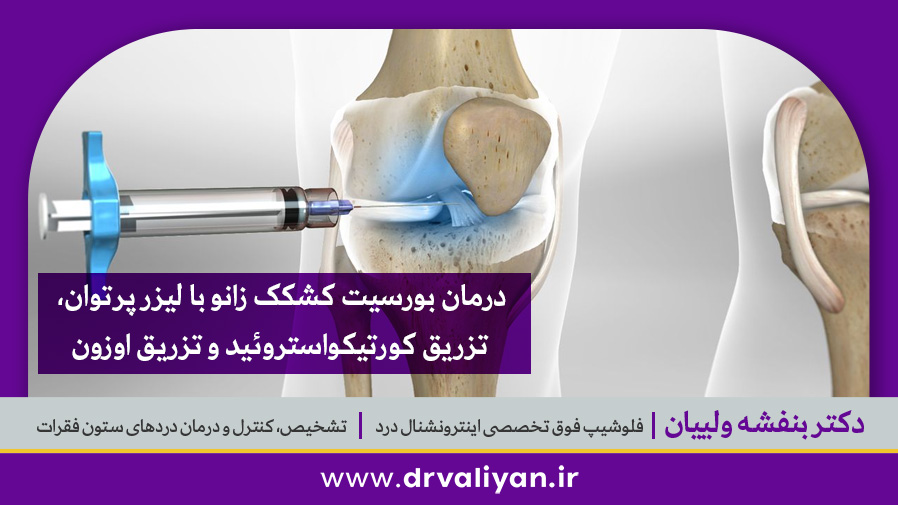 درمان بورسیت کشکک زانو