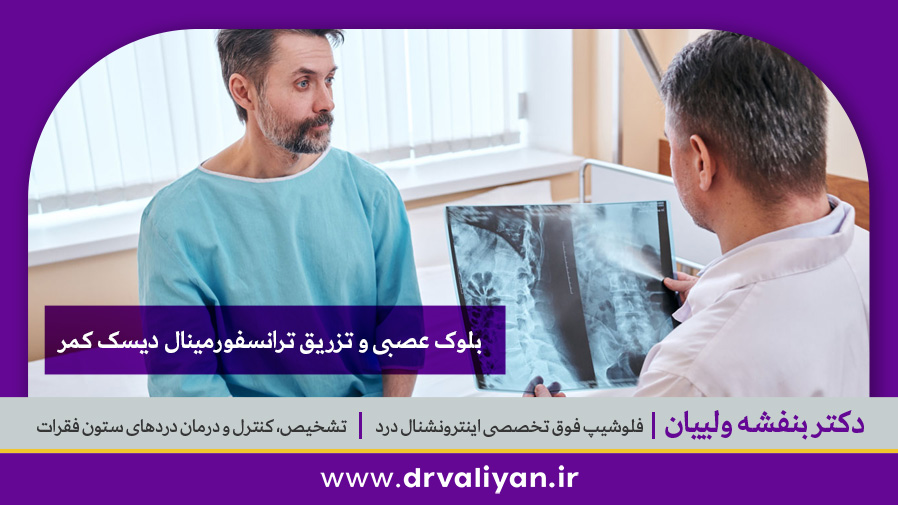 تزریق ترانسفورمینال دیسک کمر