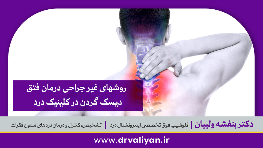 فتق دیسک گردن