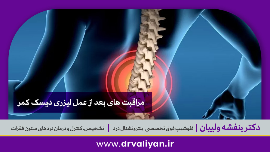 مراقبت های بعد از عمل لیزری دیسک