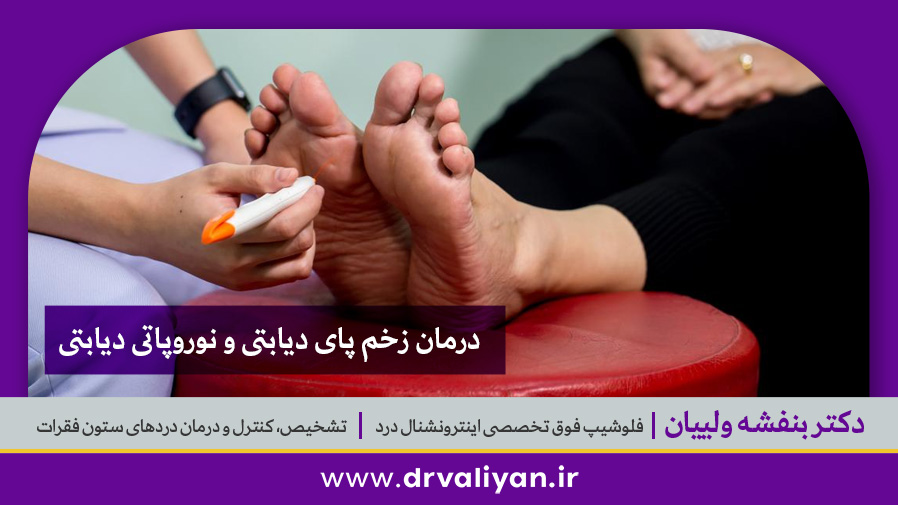 درمان زخم پای دیابتی