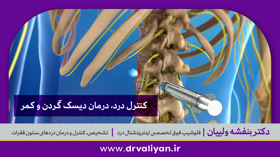 بلوک سمپاتیک کمری