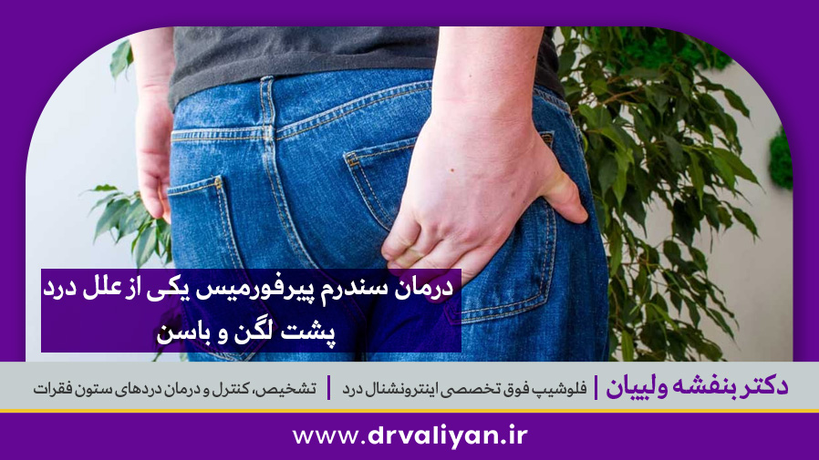 درمان سندرم پیرفورمیس