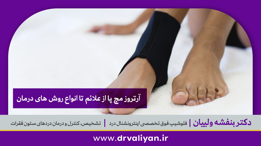 آرتروز مچ پا