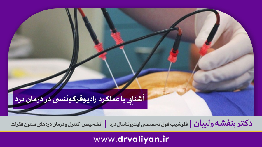 عملکرد رادیوفرکوئنسی در درمان درد