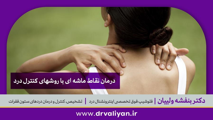 درمان نقاط ماشه ای با روشهای کنترل درد