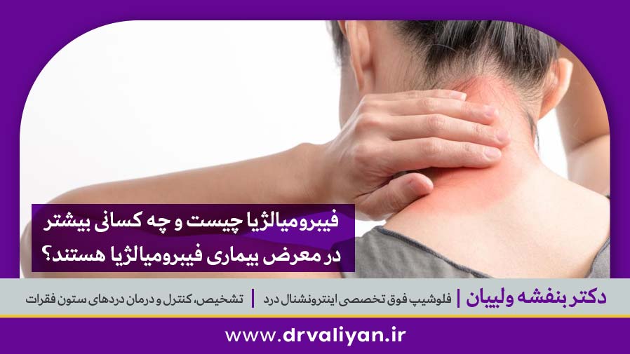 فیبرومیالژیا