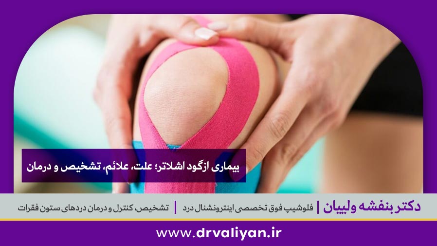 بیماری ازگود اشلاتر