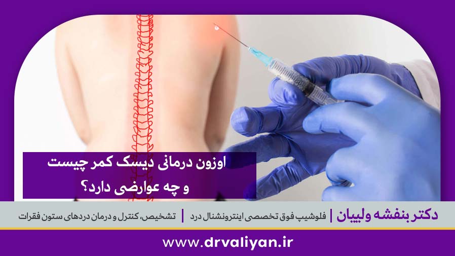 اوزون درمانی دیسک کمر