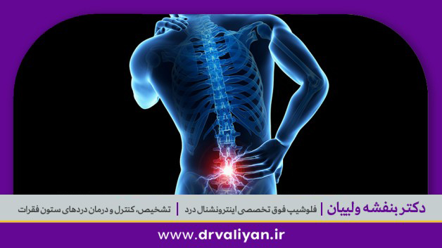 درد دنبالچه یا کوکسیدینیا 