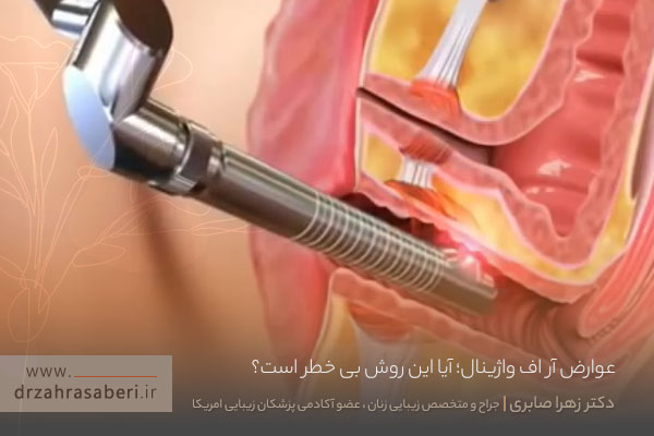 عوارض آر اف واژینال