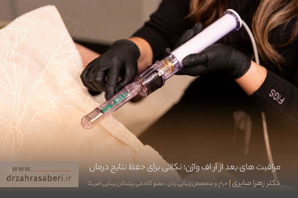 مراقبت بعد از آر اف واژن 