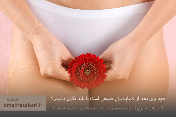 خونریزی بعد از لابیاپلاستی