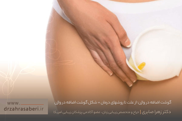 گوشت اضافه واژن چیست