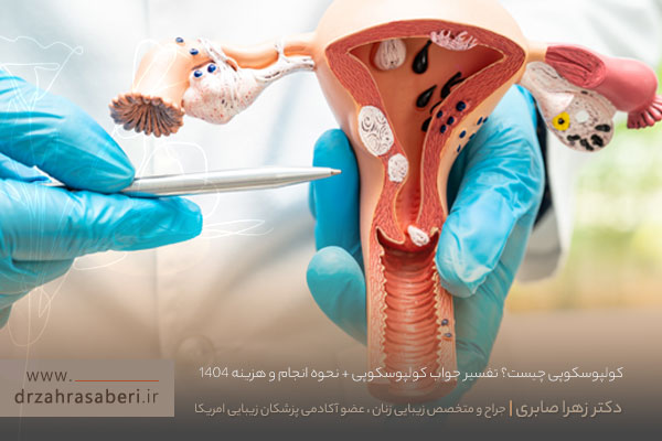 کولپوسکوپی چیست؟