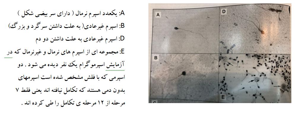 درباره اسپرم