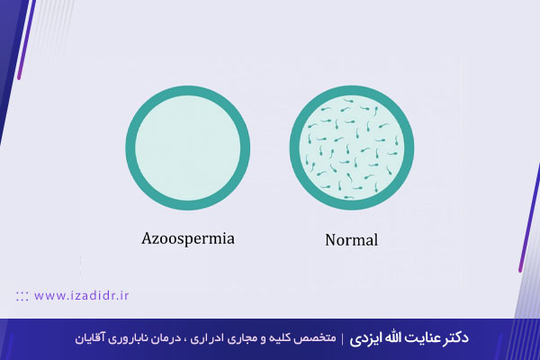 آزوسپرمی