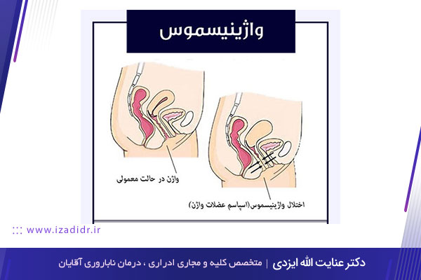 واژینیموس یا دخول دردناک