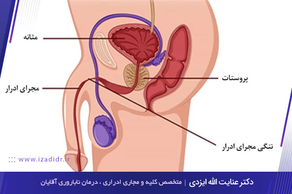 کجی آلت تناسلی