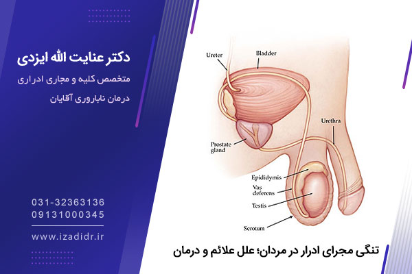 تنگی مجاری ادرار در مردان