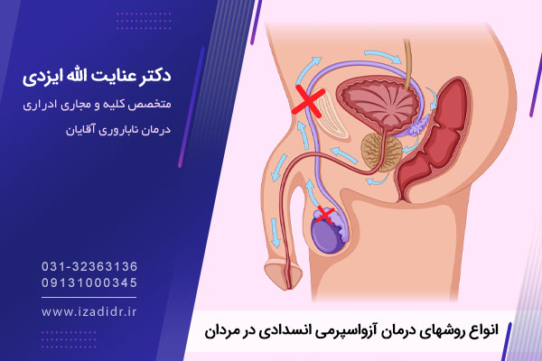 آزواسپرمی انسدادی 