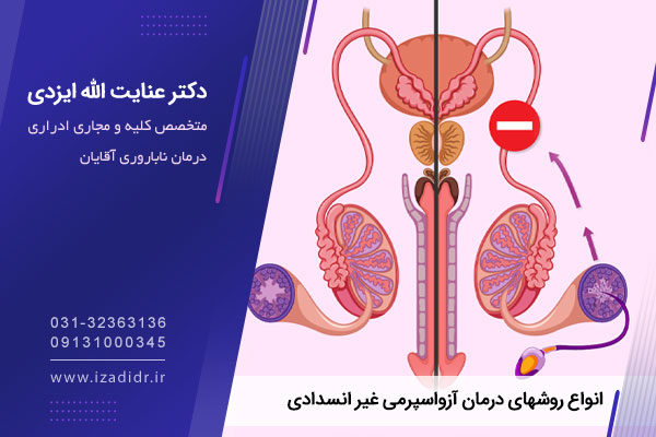 آزواسپرمی غیر انسدادی