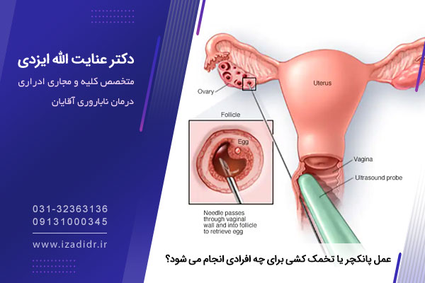 تخمک کشی چیست