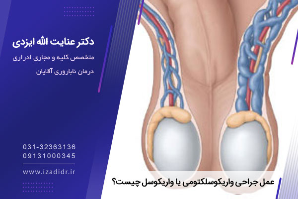 عمل جراحی واریکوسلکتومی