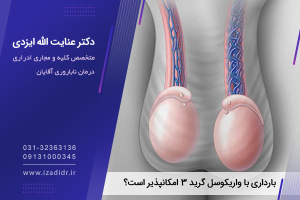 واریکوسل گرید 3