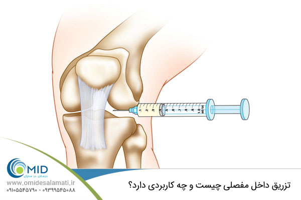 کاربرد تزریق مفصلی