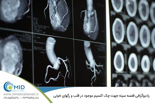 رادیوگرافی قفسه سینه