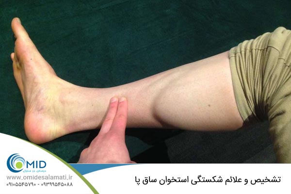 تشخیص و علائم شکستگی استخوان ساق پا