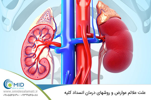 درمان انسداد کلیه