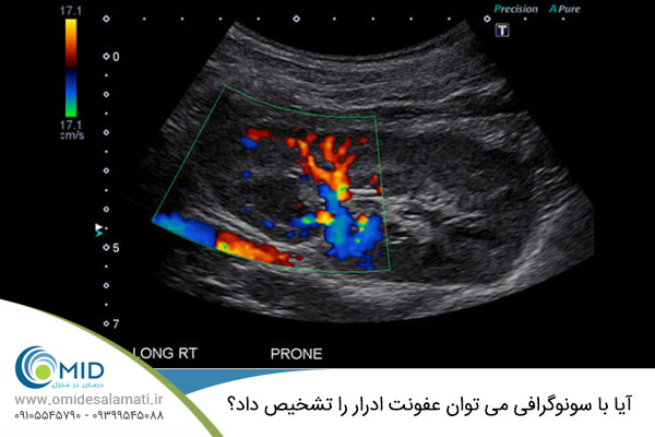 سونوگرافی تشخیص عفونت ادراری