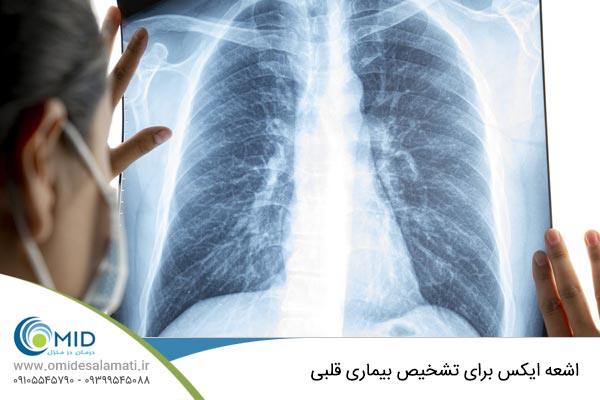 اشعه ایکس برای تشخیص بیماری قلبی