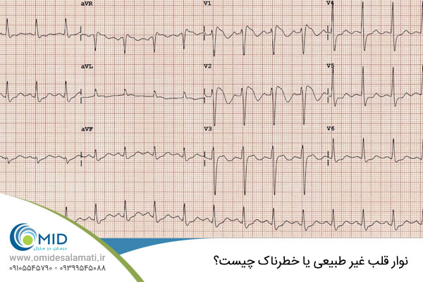 نوار قلب غیر طبیعی و خطر ناک 